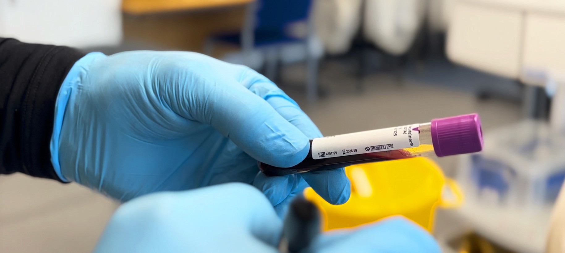 Blood test in The Physiology Centre, Brentwood, Romford, Essex, Fast Results