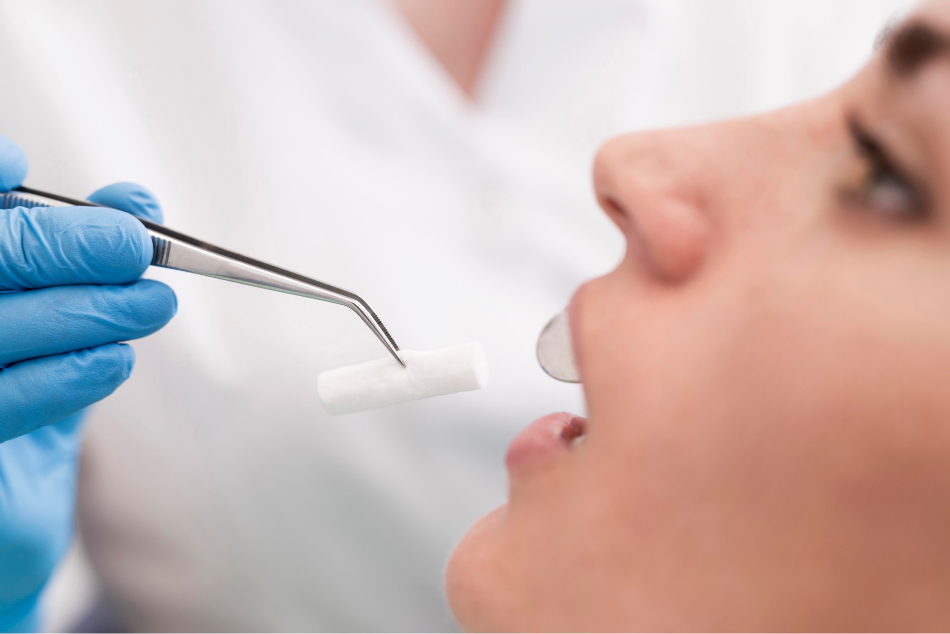 Dentist placing a cotton roll in the patient's mouth during a dental procedure.