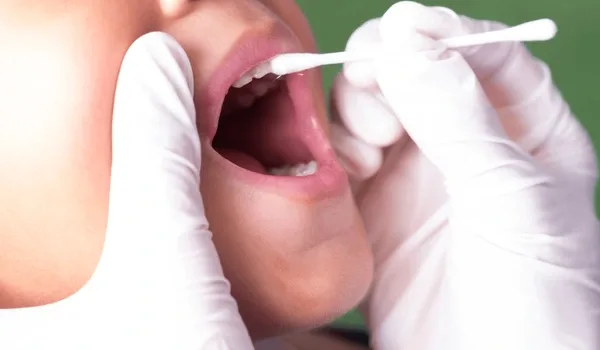 Fluoride Treatment
