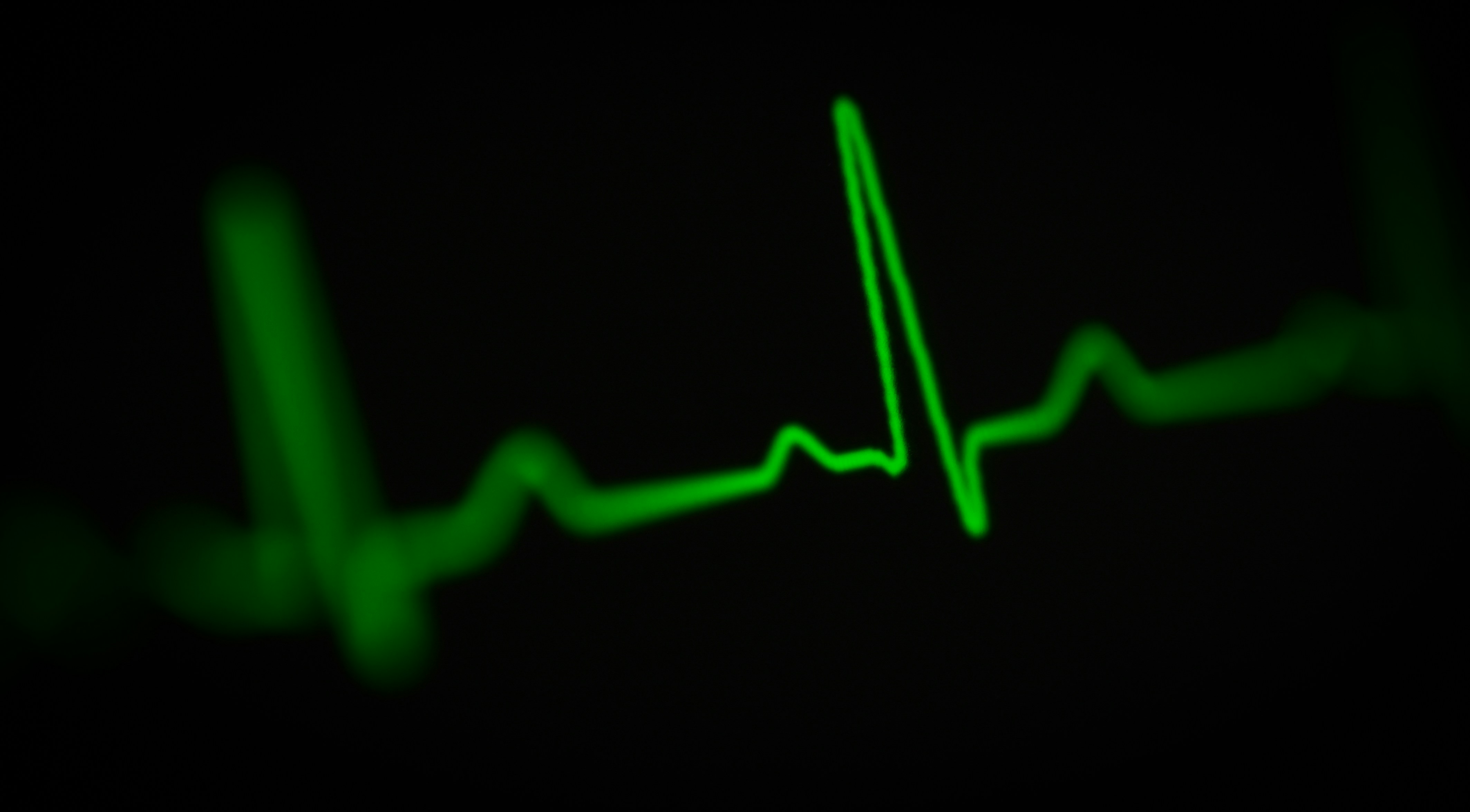 a green heart beat on a black background