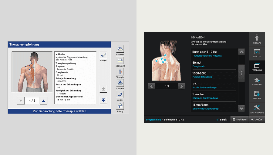 Before and after — interface treatment details