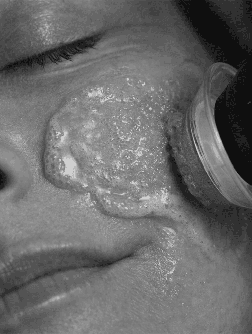 A woman getting a Glo2Facial at a spa