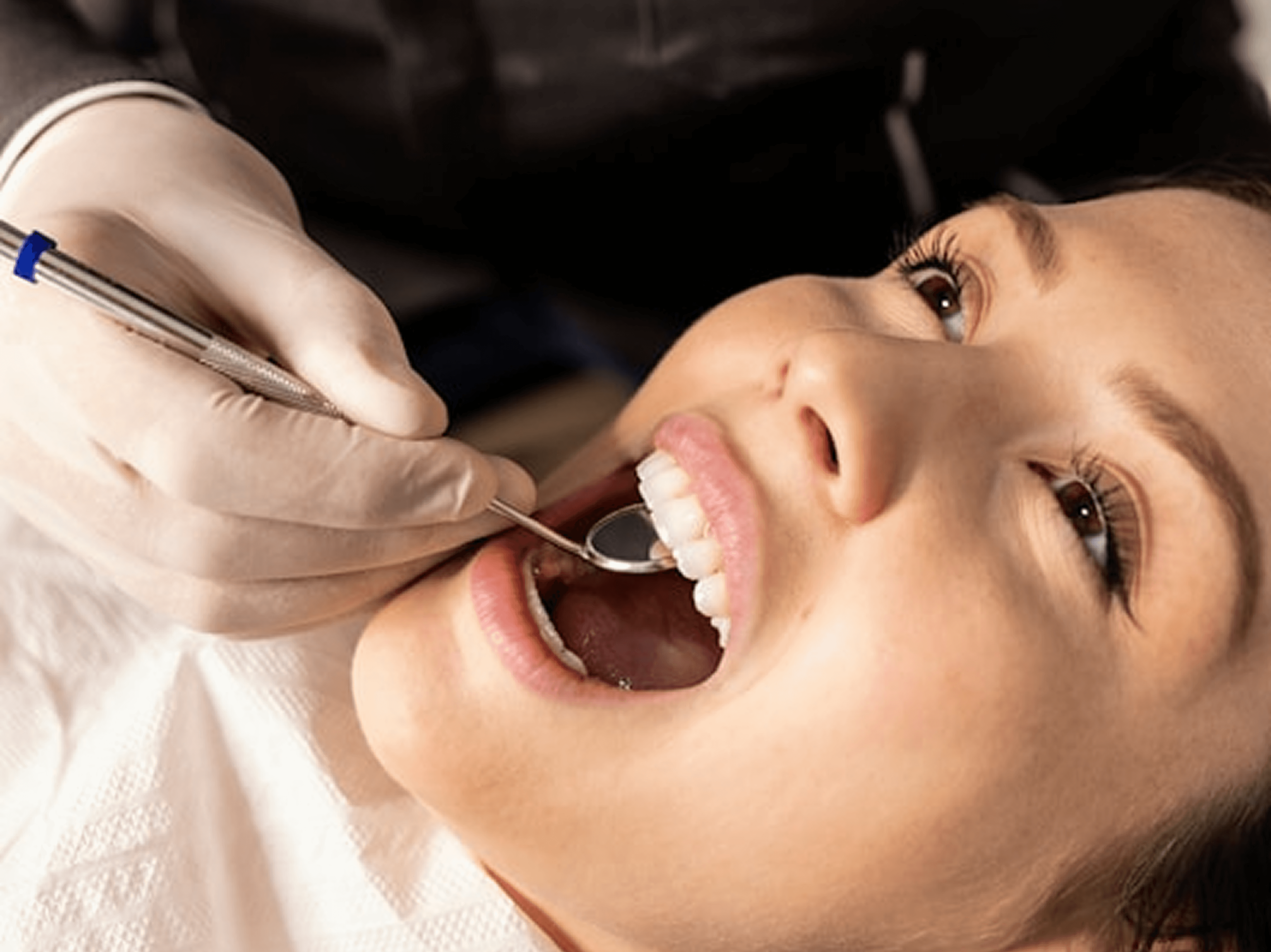 Close-up of dental check-up with gloved hands using mirror to inspect patient’s teeth and gums