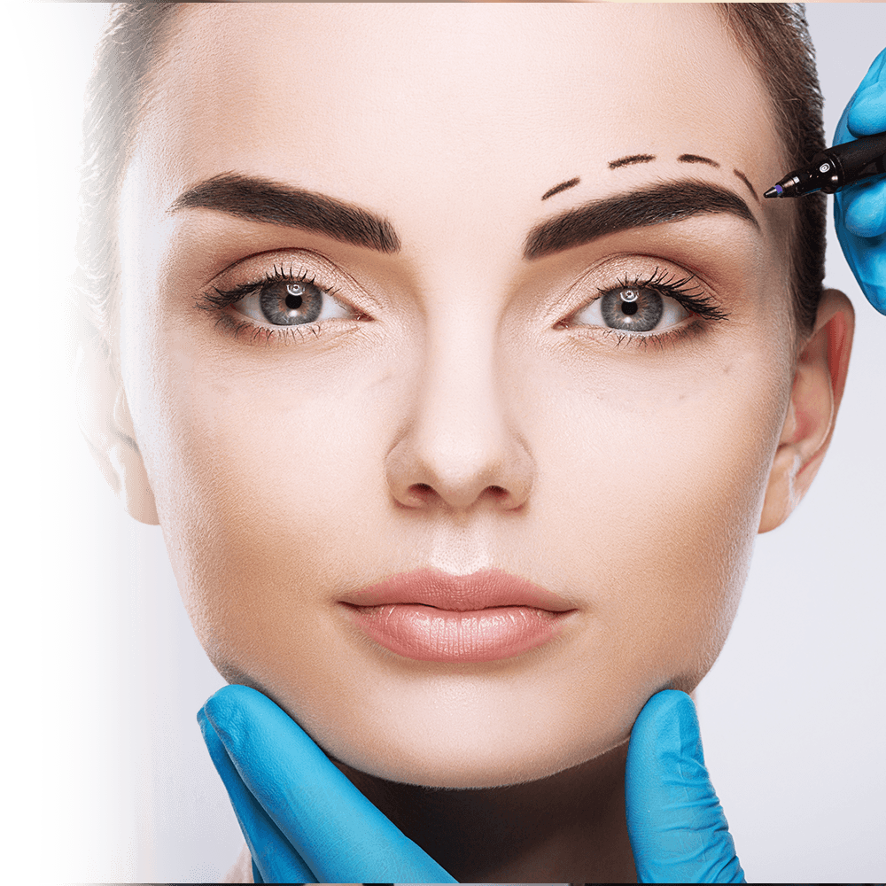 incision planning of direct browlift