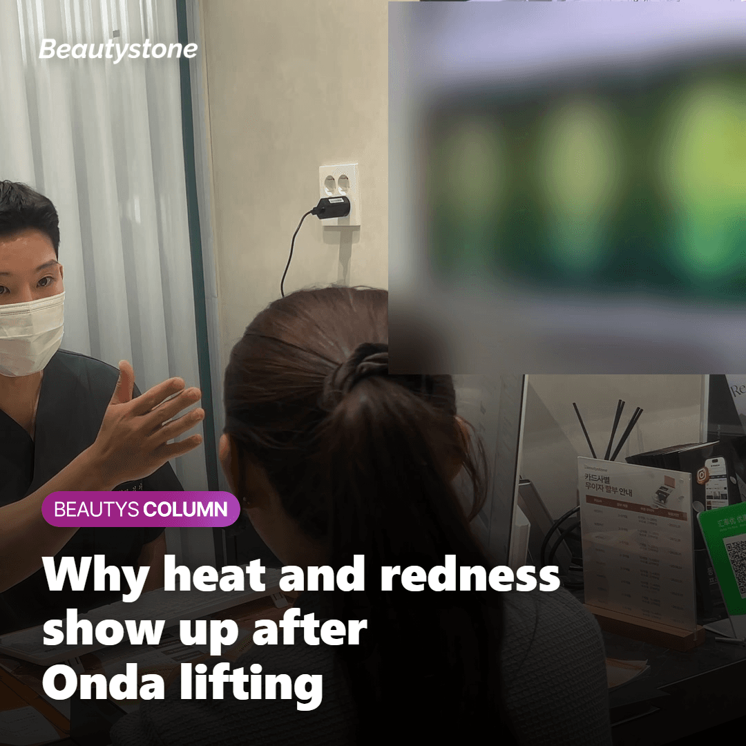Illustration showing why heat and redness show up after Onda lifting