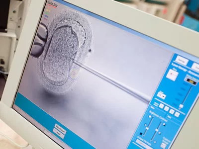 Intracytoplasmic Sperm Injection (ICSI) monitor