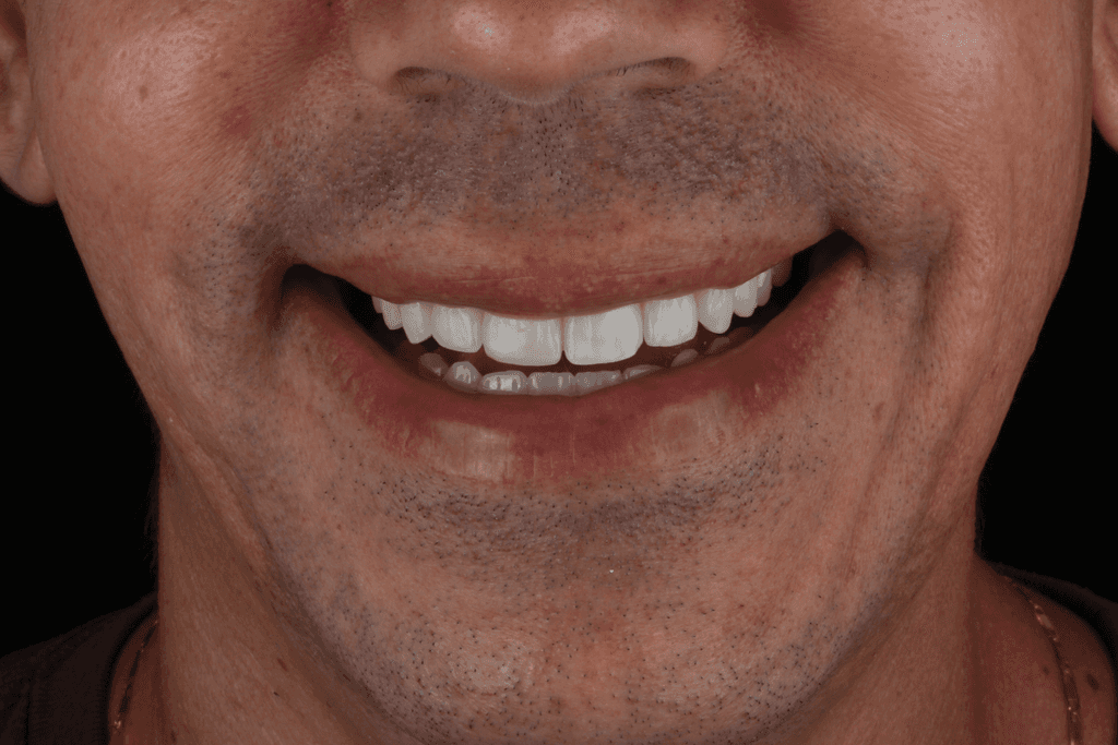 Depois do tratamento ortodôntico