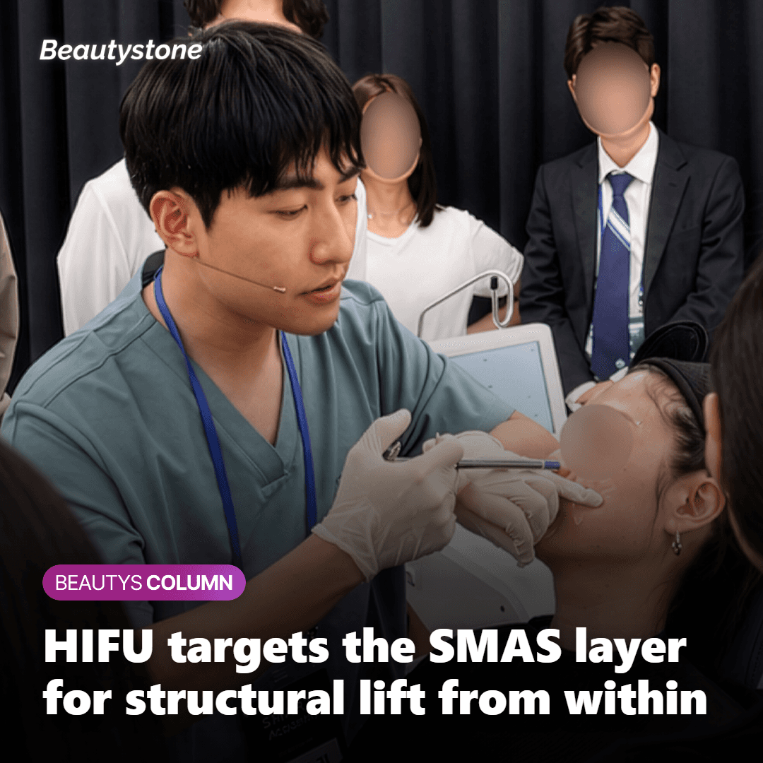 Anatomical diagram showing HIFU focused ultrasound energy targeting the SMAS layer beneath the facial skin