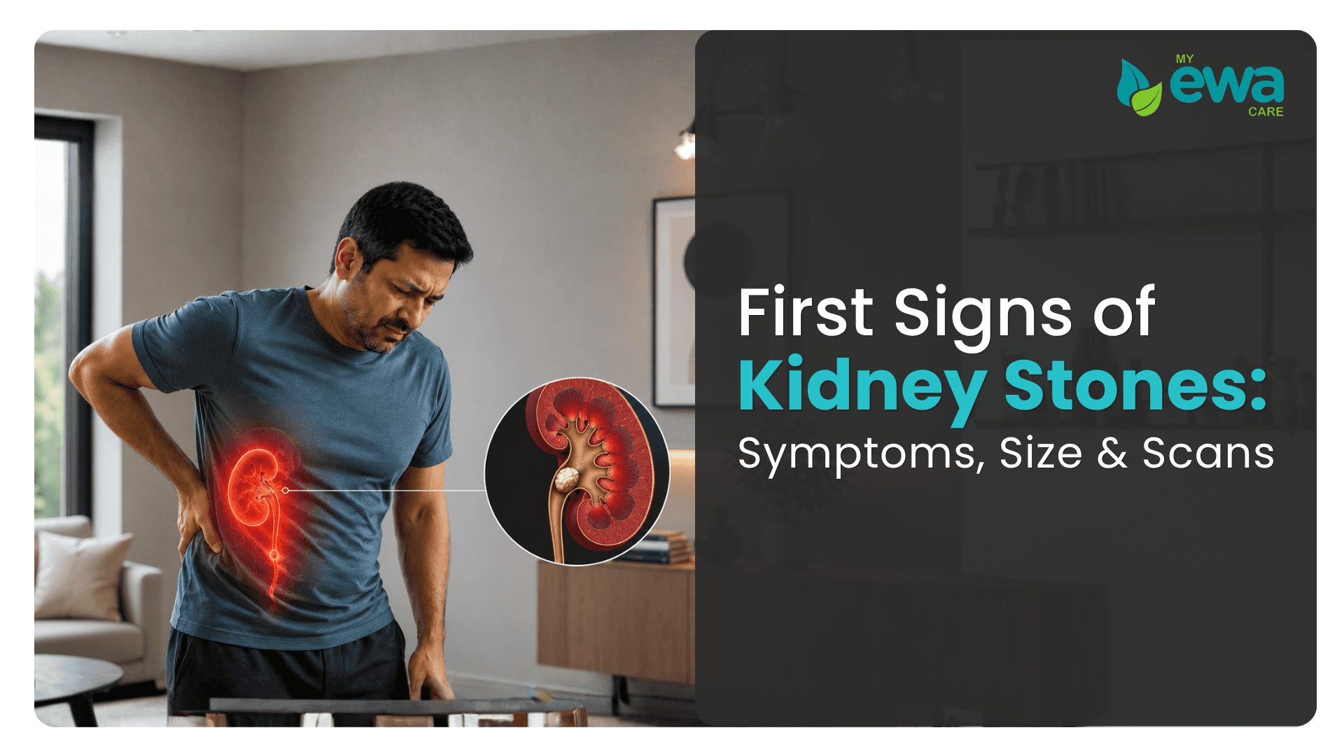 first signs of kidney stones symptoms