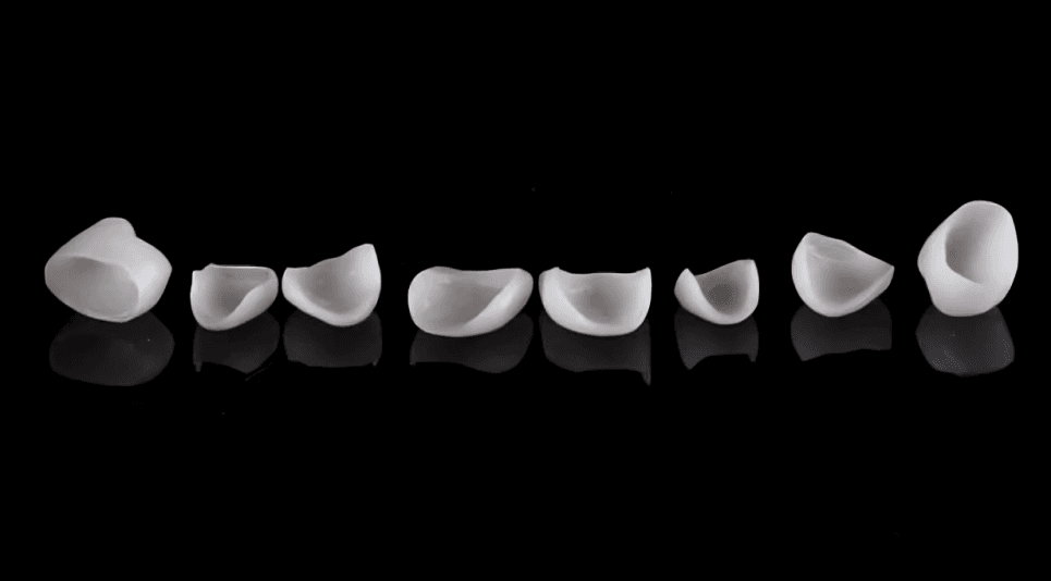 porcelain veneers