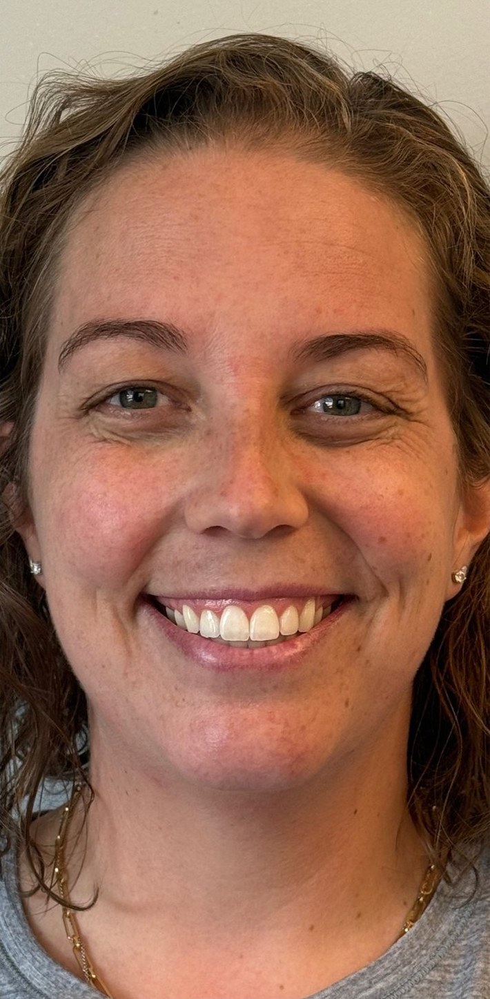 Before: a smiling woman facing the camera.