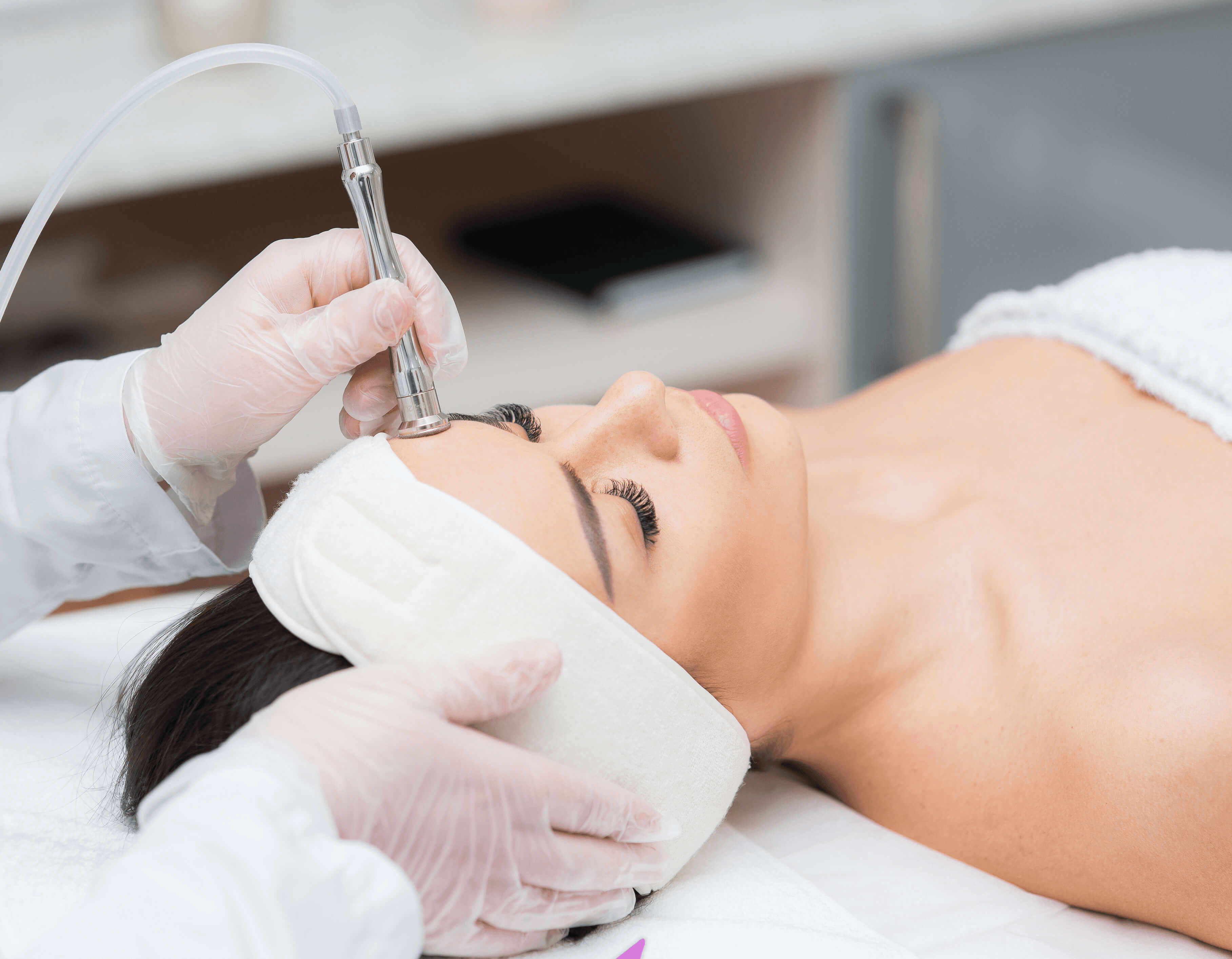 Mikrodermabrazja diamentowa twarzy, zabieg złuszczający i wygładzający skórę.