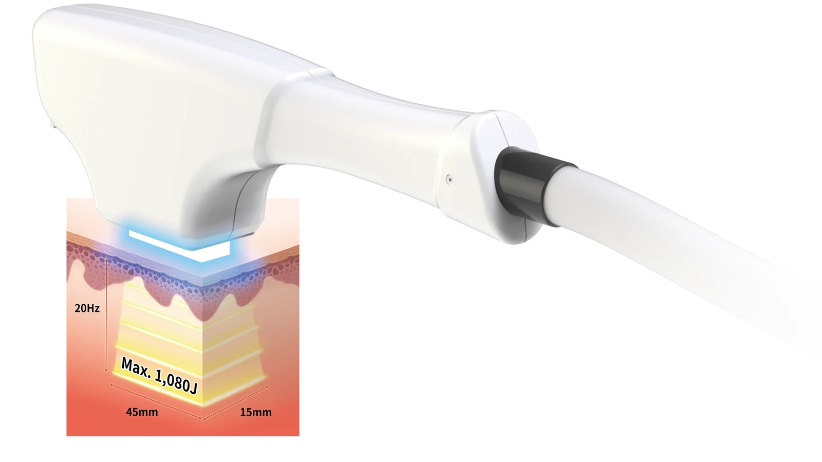 Veloce Handstück mit 45 × 15 mm Behandlungsfenster und bis zu 20 Hz Sub-Puls-Frequenz