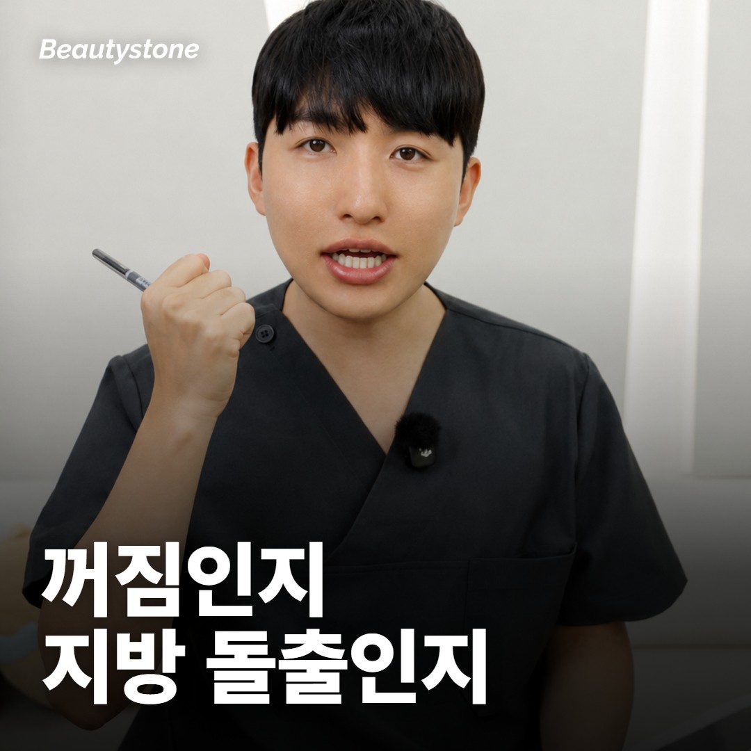 내 눈밑은 꺼짐일까요, 다른 원인일까요?