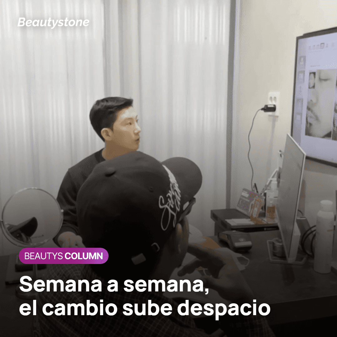 Evolución de Sculptra semana a semana: firmeza primero y volumen después