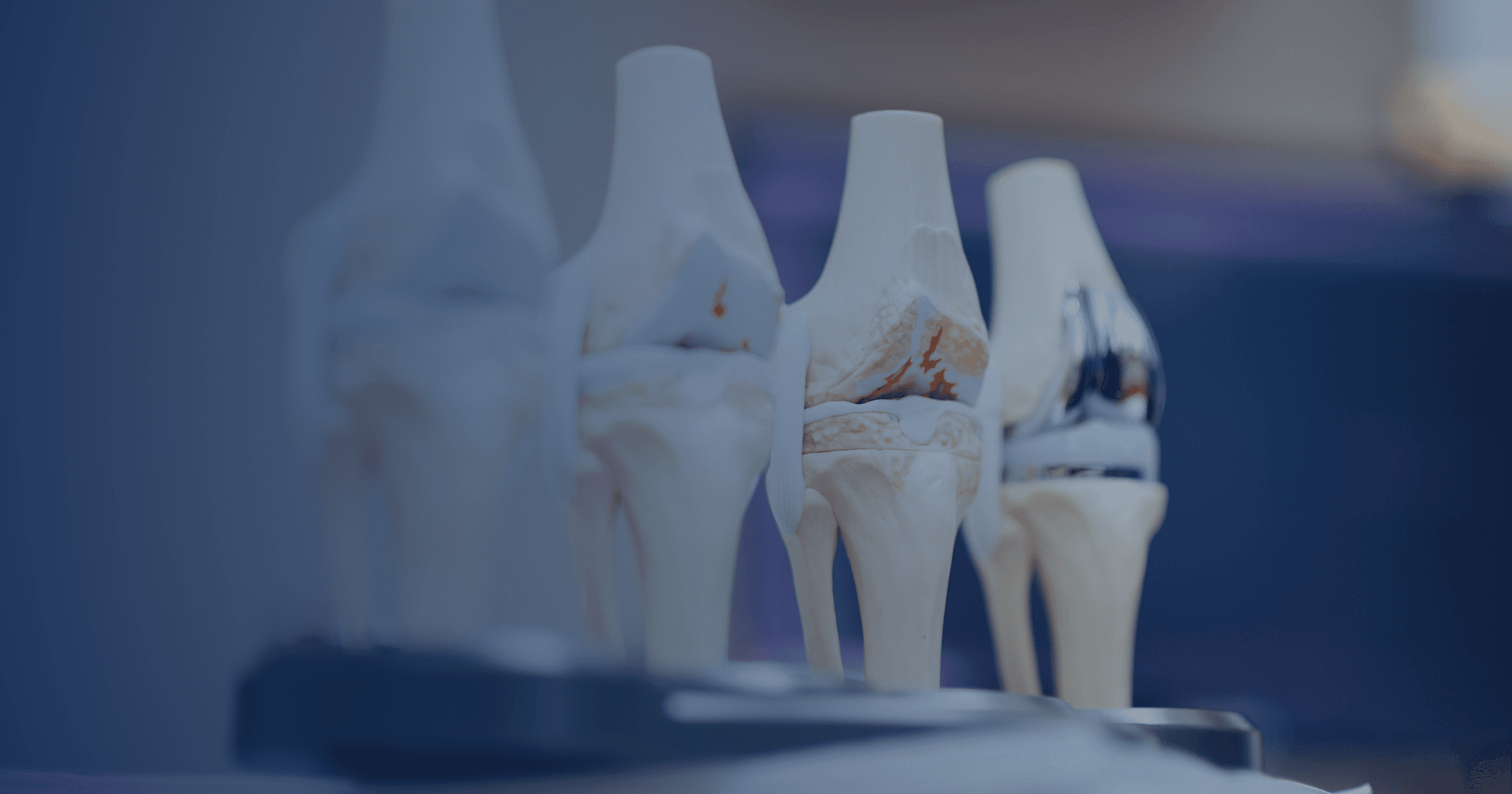 PROMs en orthopédie : le cas du CHU de Québec \ Lime Santé