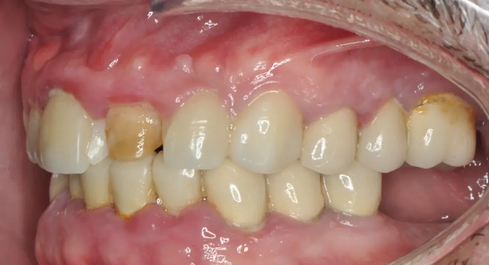 Before ortho treatment