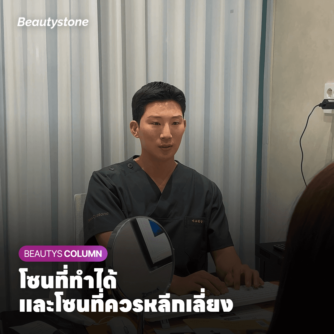 แผนภาพโซนรอบดวงตาที่สามารถทำ Secret RF ได้และโซนที่ควรหลีกเลี่ยง