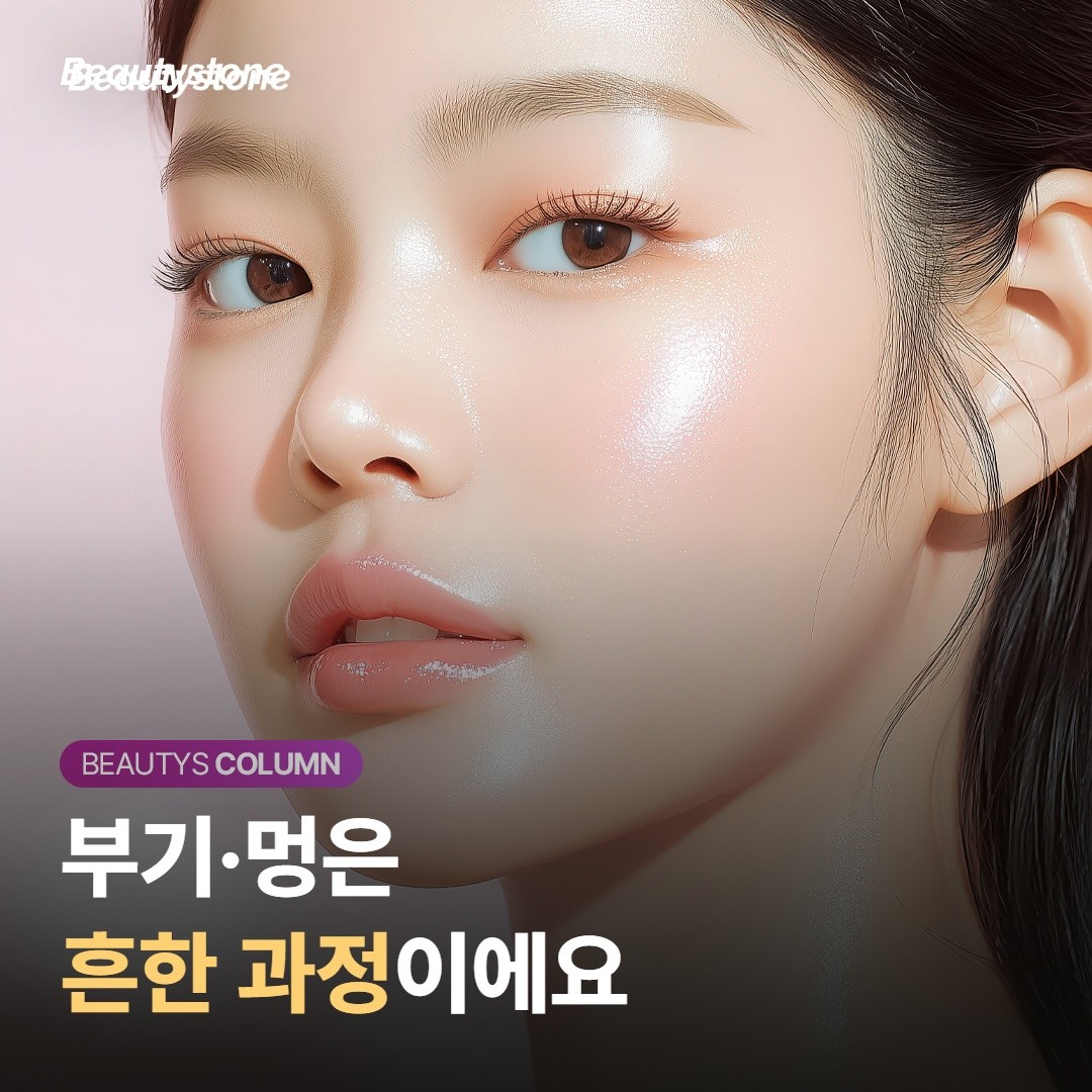 흔한 반응 — 대부분 며칠이면 가라앉아요