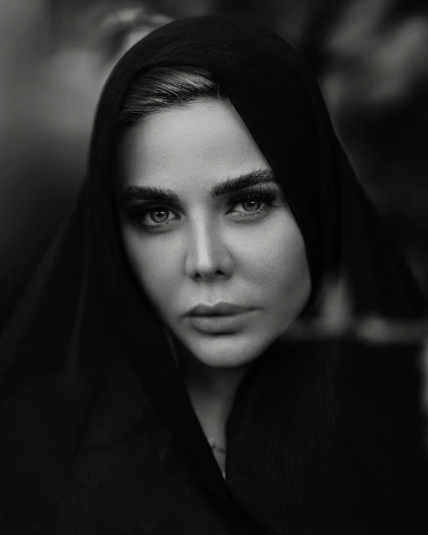 Miami Face Lift (Rhytidectomy)