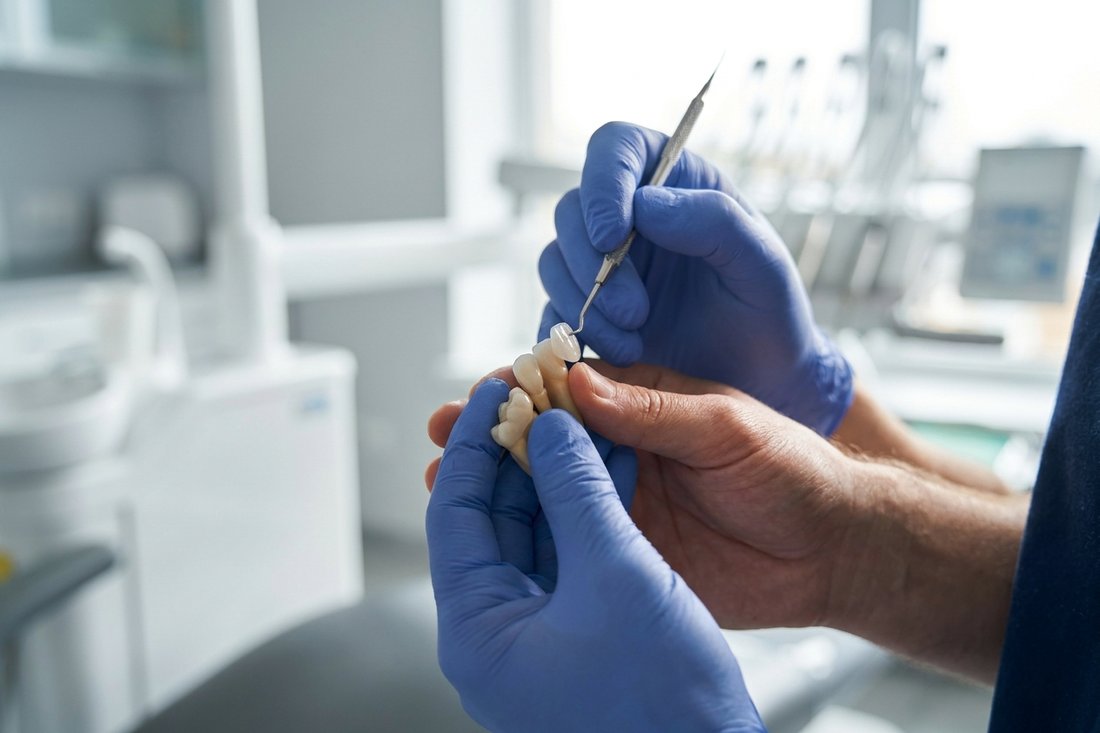 Dentist demonstrating how a veneer covers the front surface of a tooth model