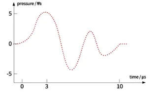 체외충격파 치료 시 압력 파형 변화를 나타낸 그래프