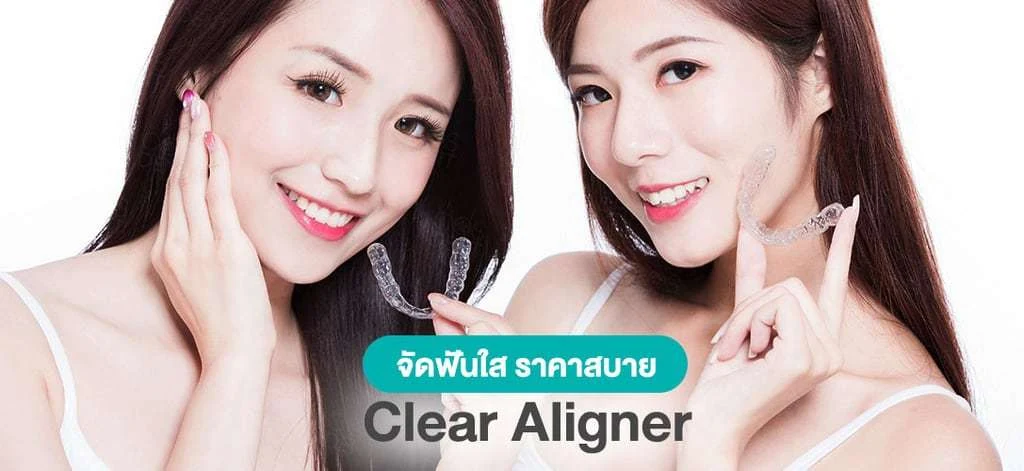 Clear aligner treatment at COSDENT Smile Design