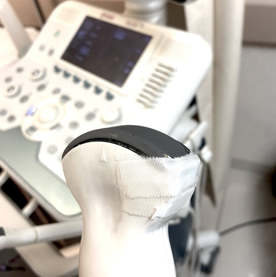 Transductor dañado en el frende de fotografía