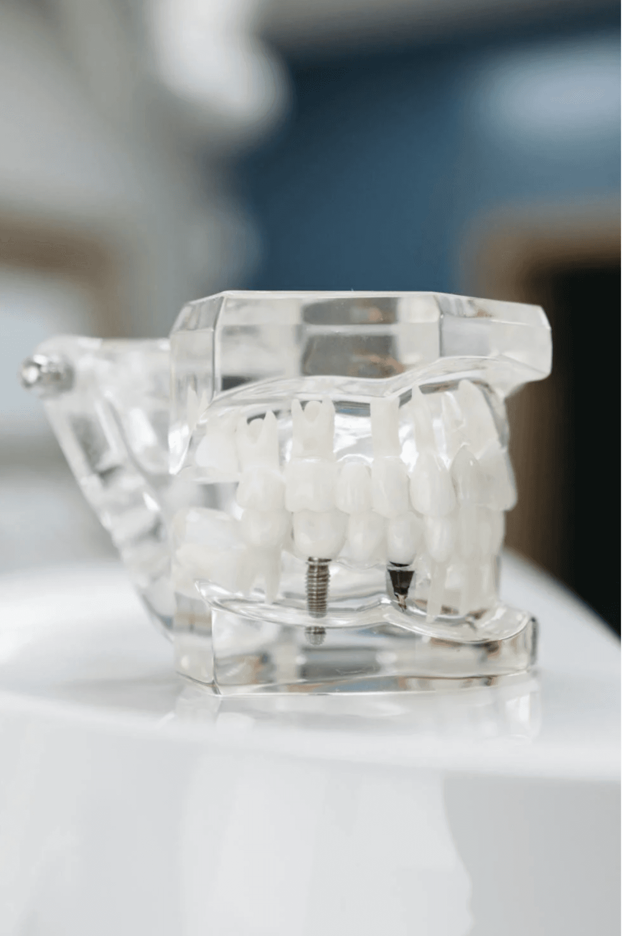 Image of a jaw/dental mockup. Courtesy of Pexels