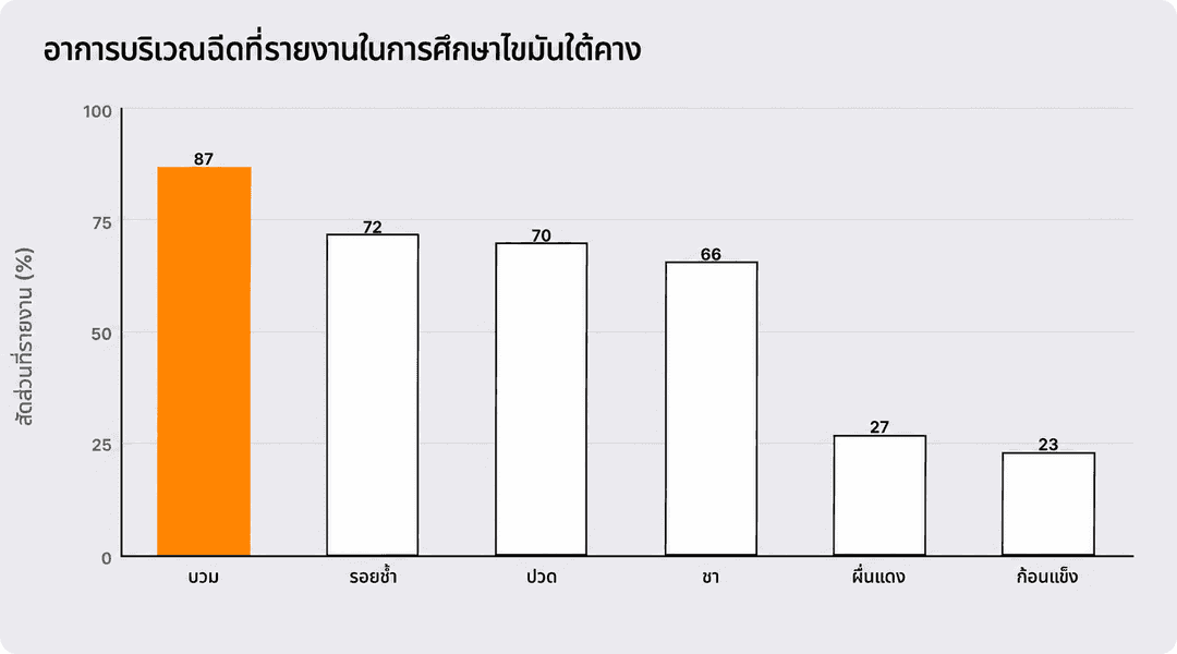 ทำไมระยะเวลาของอาการบวมและการสลายของไขมันจากการฉีด DCA ถึงไม่เท่ากัน