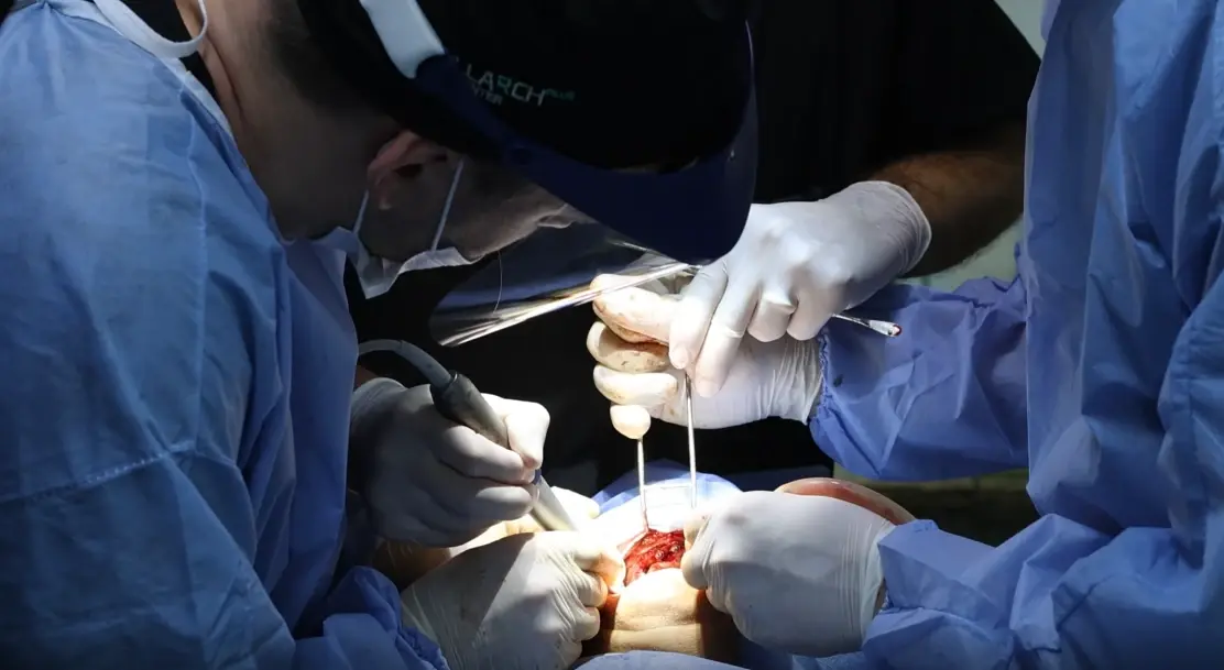 6 - 8 Surgeries, Performed by You