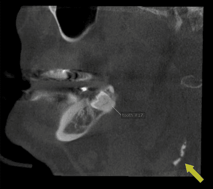Dark mode compatible CBCT illustration