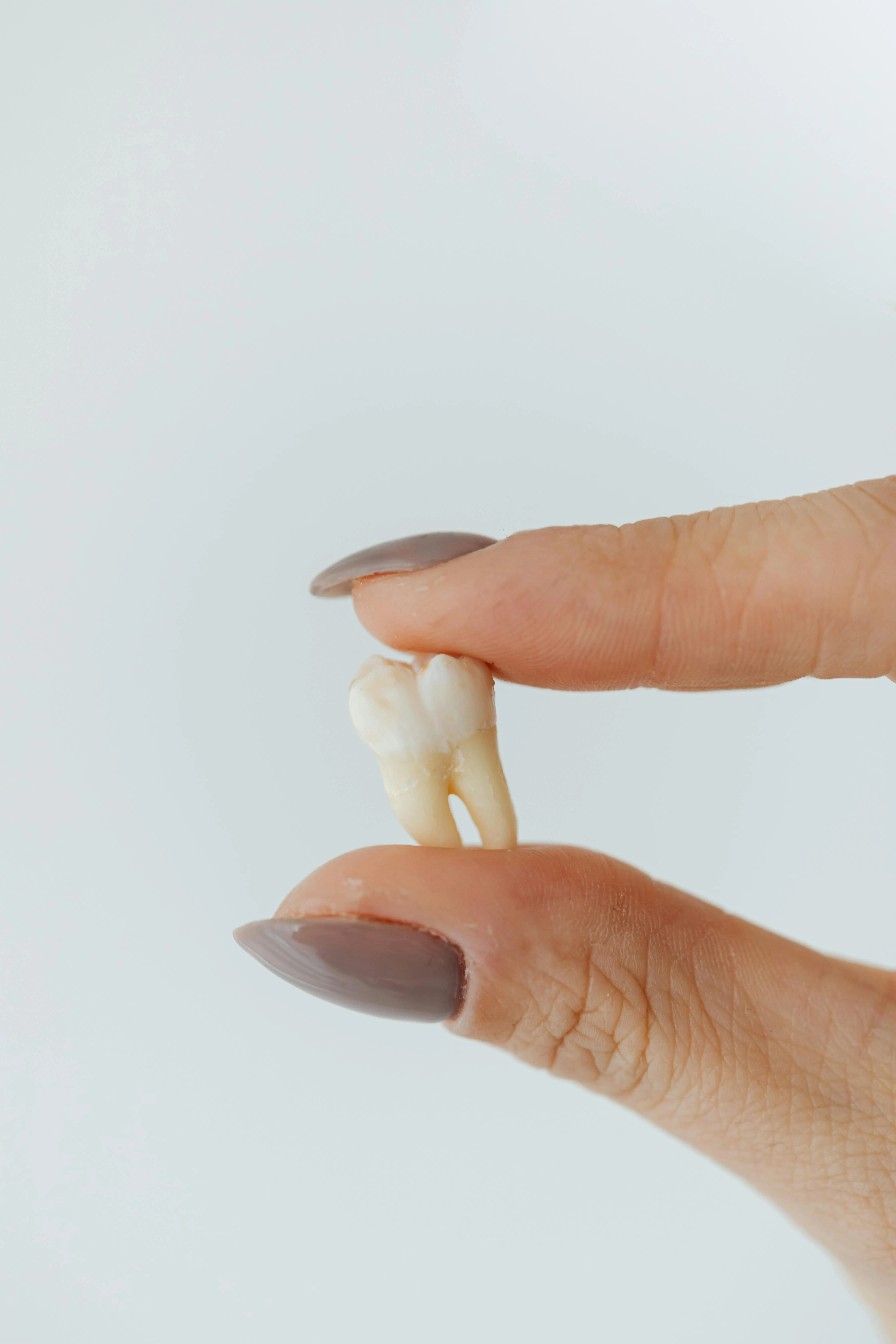 A person holding their wisdom tooth after Wisdom Teeth Removal at Midtown Dental Studio on Eglinton in Midtown Toronto, Ontario | Best Dentist in Midtown Toronto, Ontario