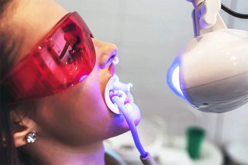 Teeth whitening near me