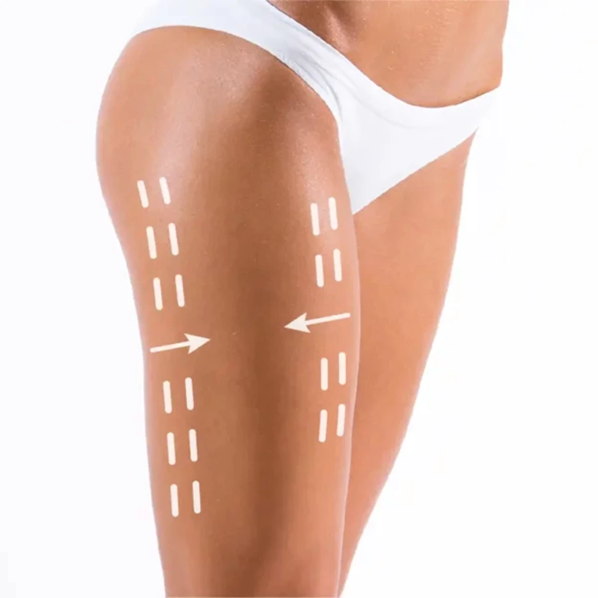 Fettabsaugungder Reiterhosen