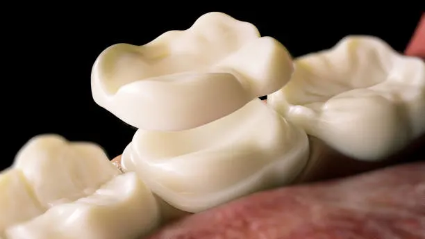Intraoral Cameras