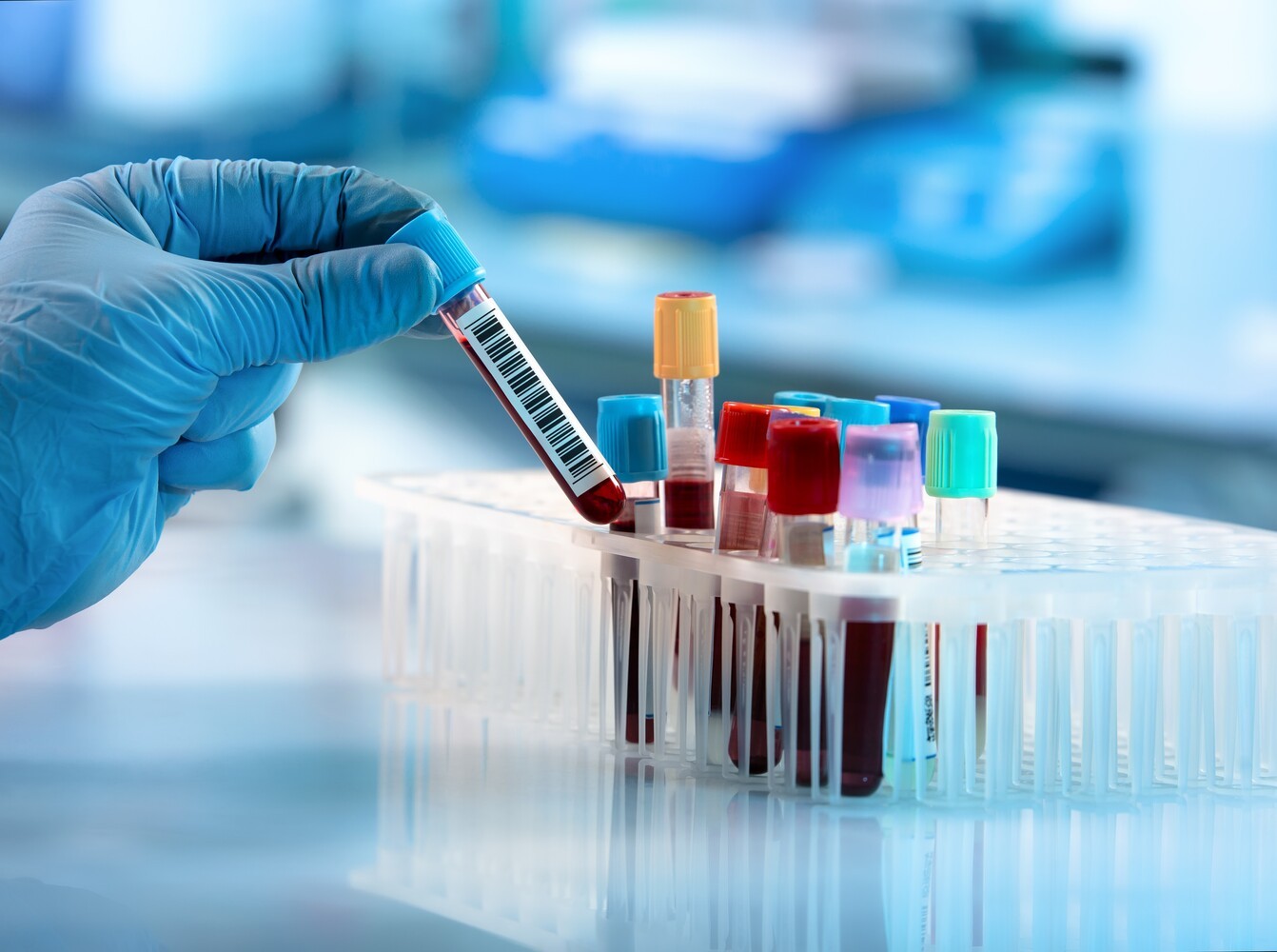 hypothyroidism treatment weight loss