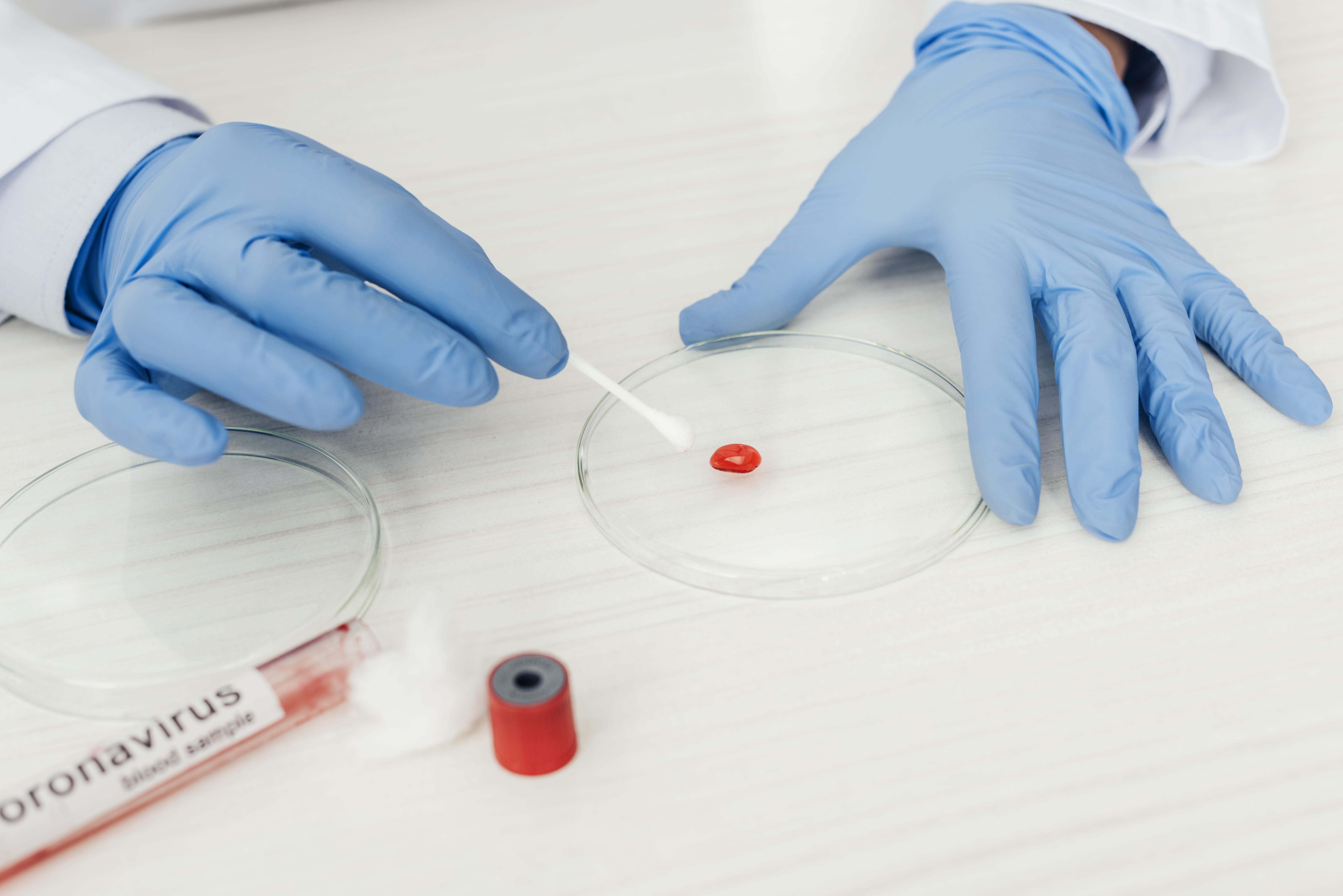 A medical laboratory scientist working on blood smples.