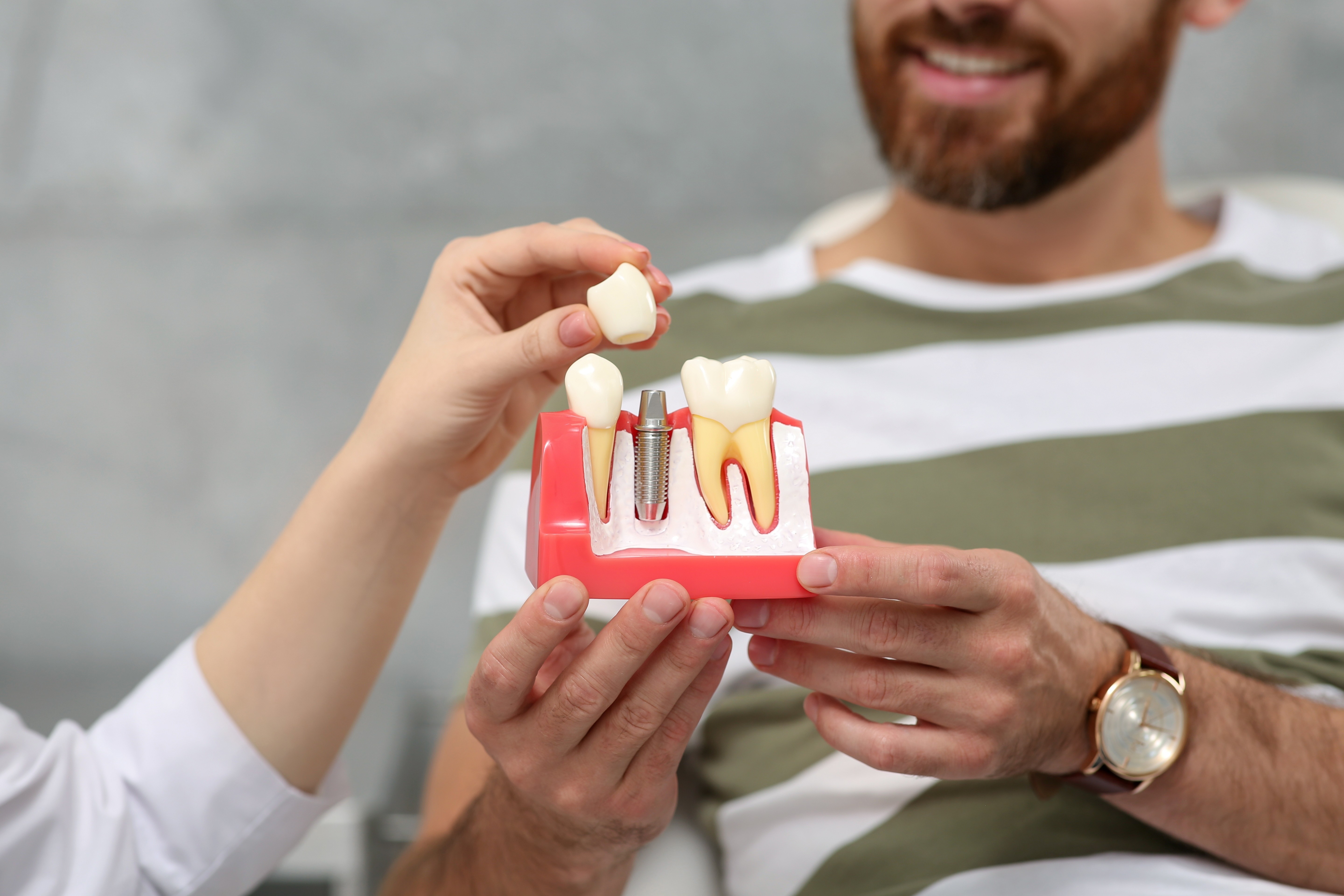 what are dental implants, explained by Invisalign Center's specialist Dr Chanavaz