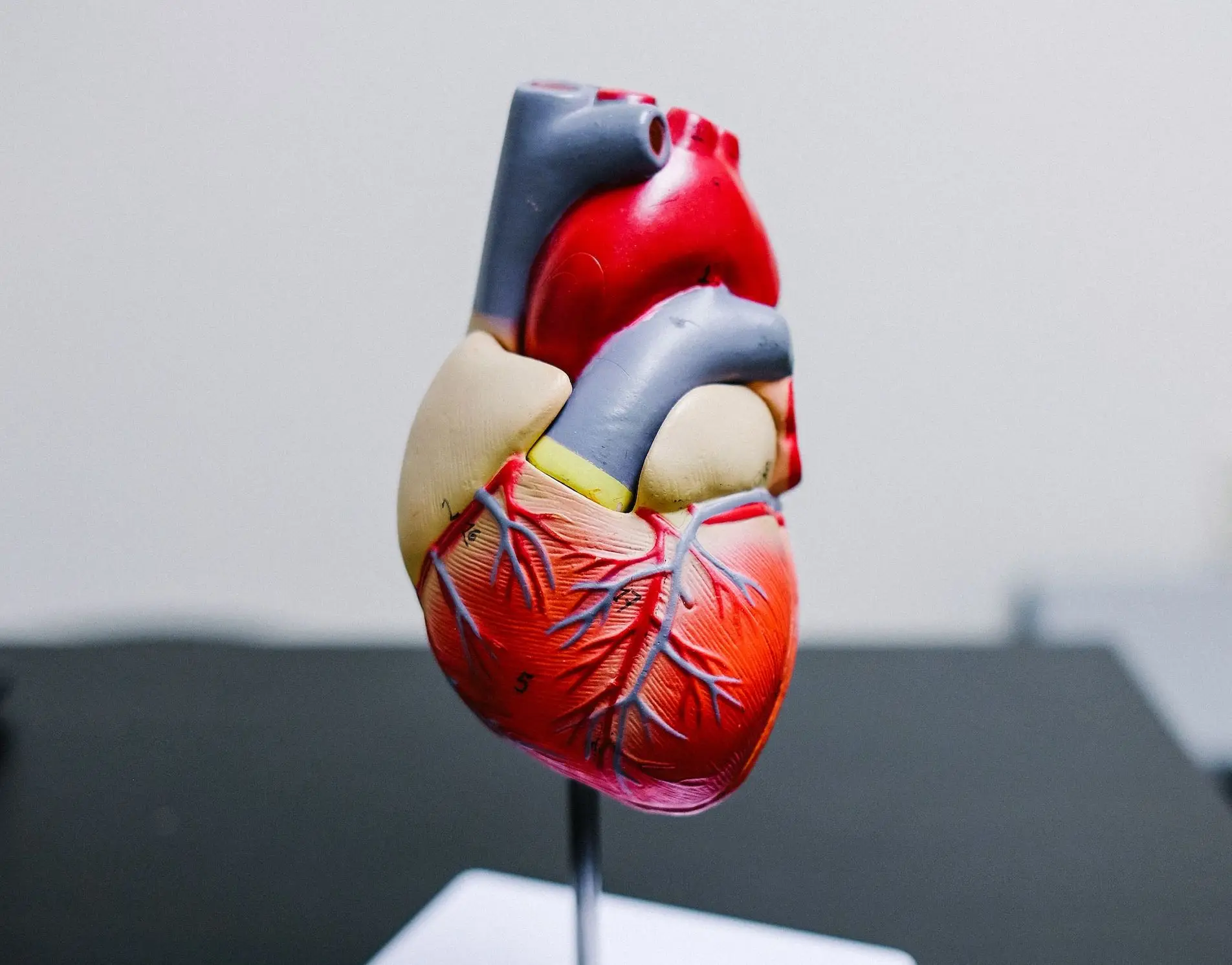Angioplasty: What to Know Before and After Your Surgery