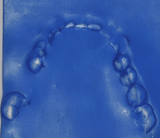 Occlusograms