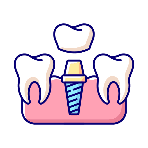 Dental implant tooth replacement icon