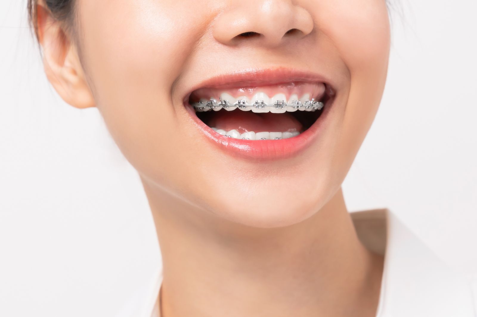 Brighten Your Smile