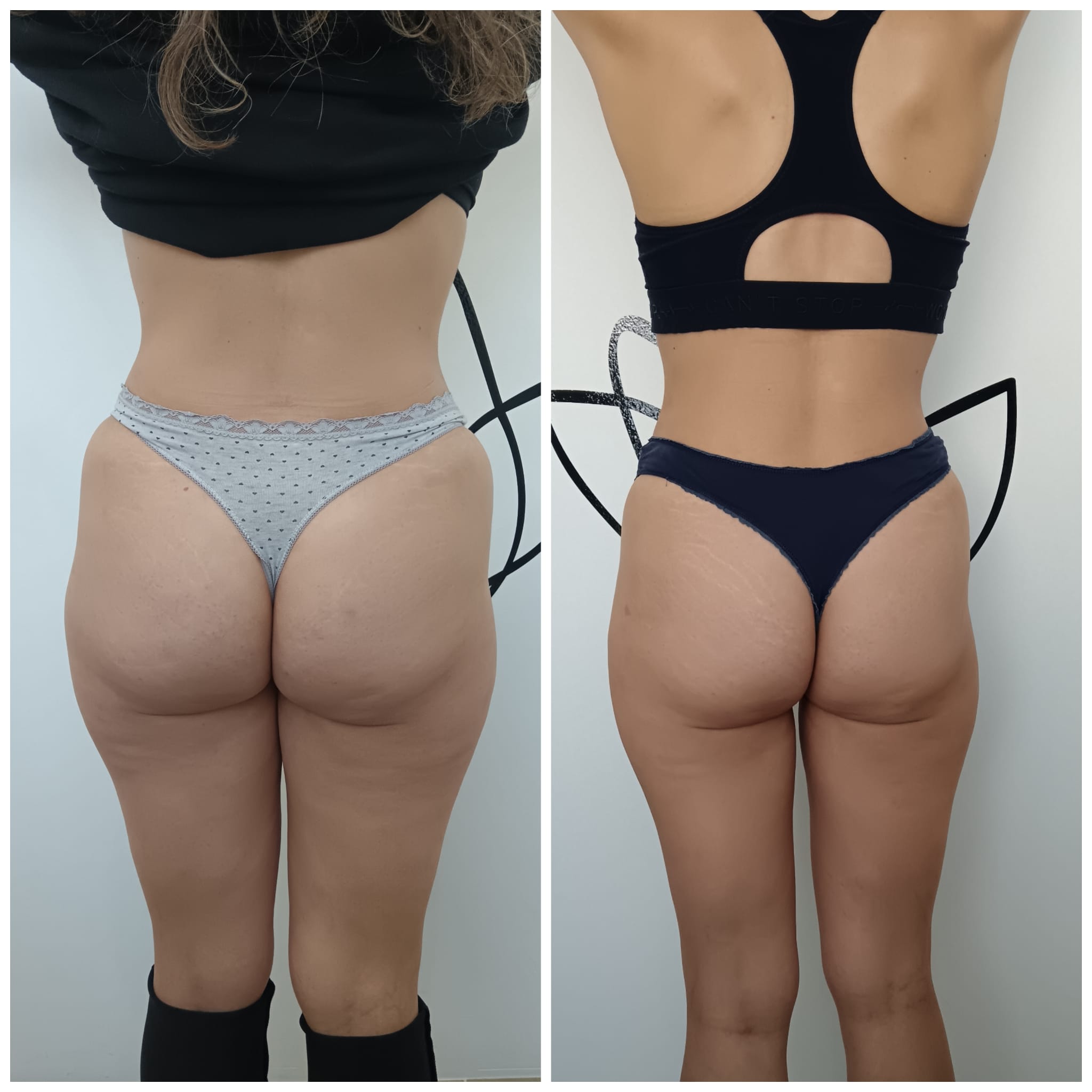 Transformation Photo