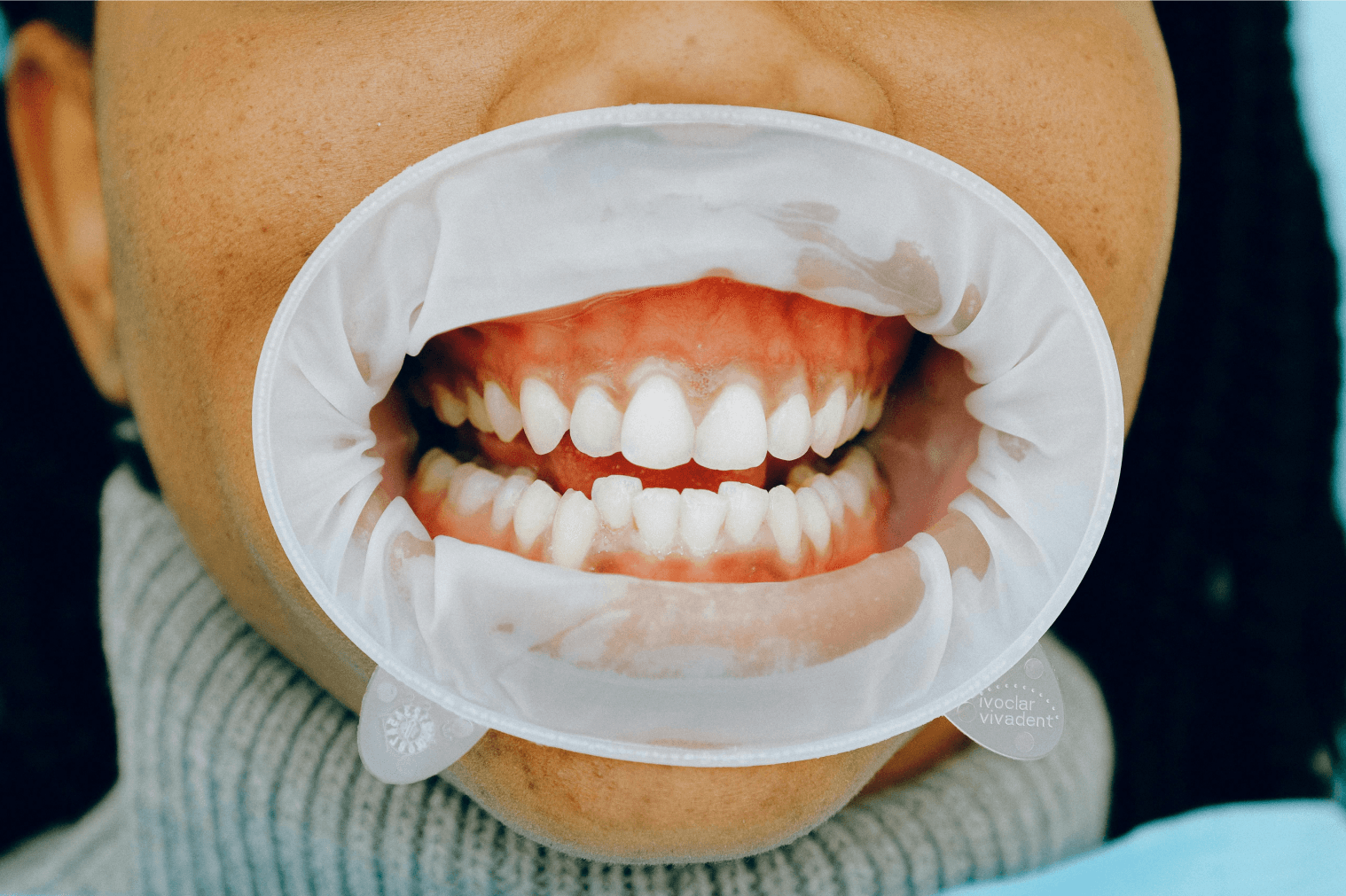 Healthy Gums