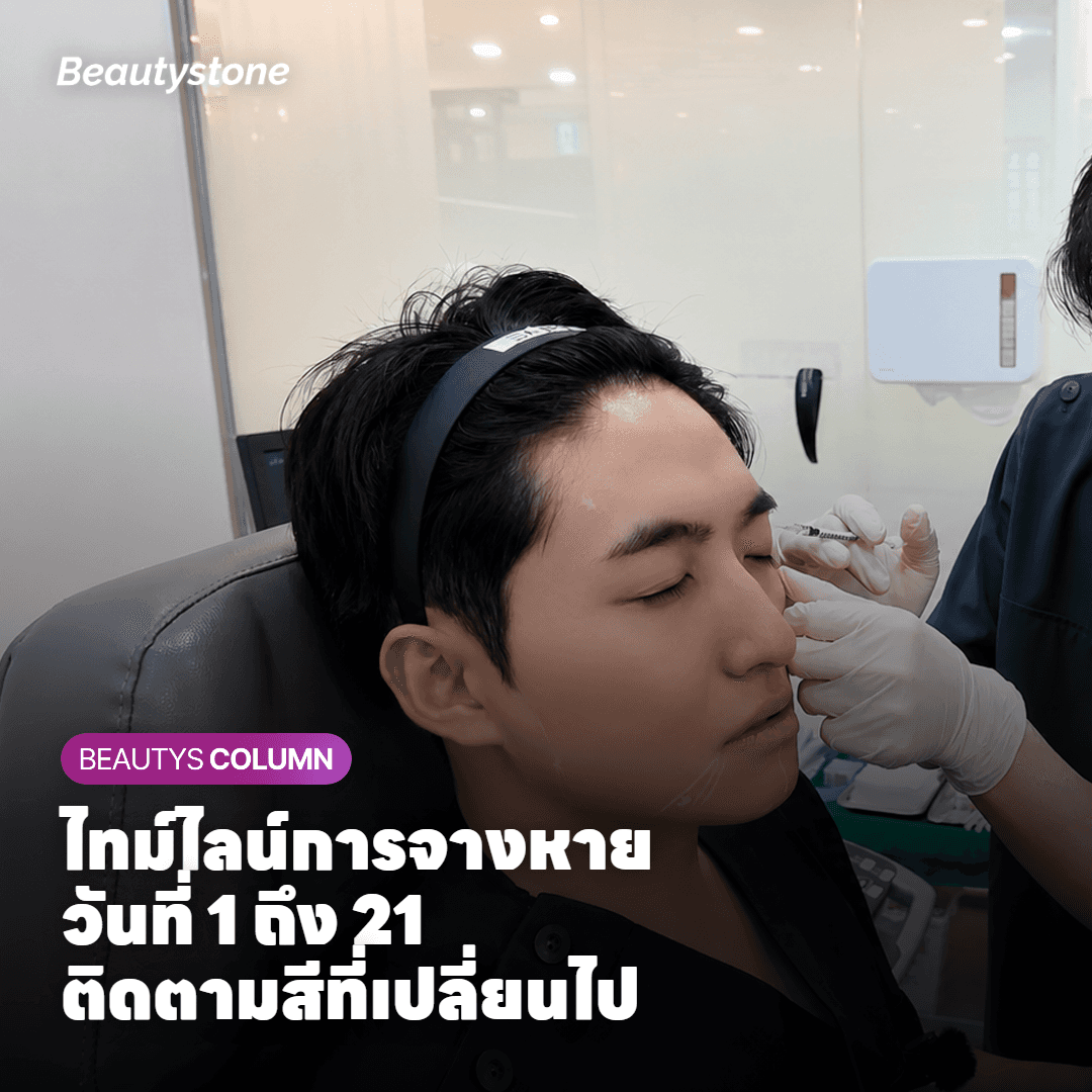 ไทม์ไลน์การจางหายของรอยเข็มและรอยฟกช้ำ