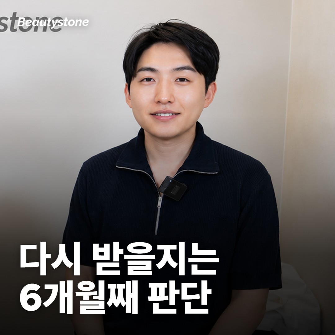 아이 써마지는 한 번 받으면 충분한가요?