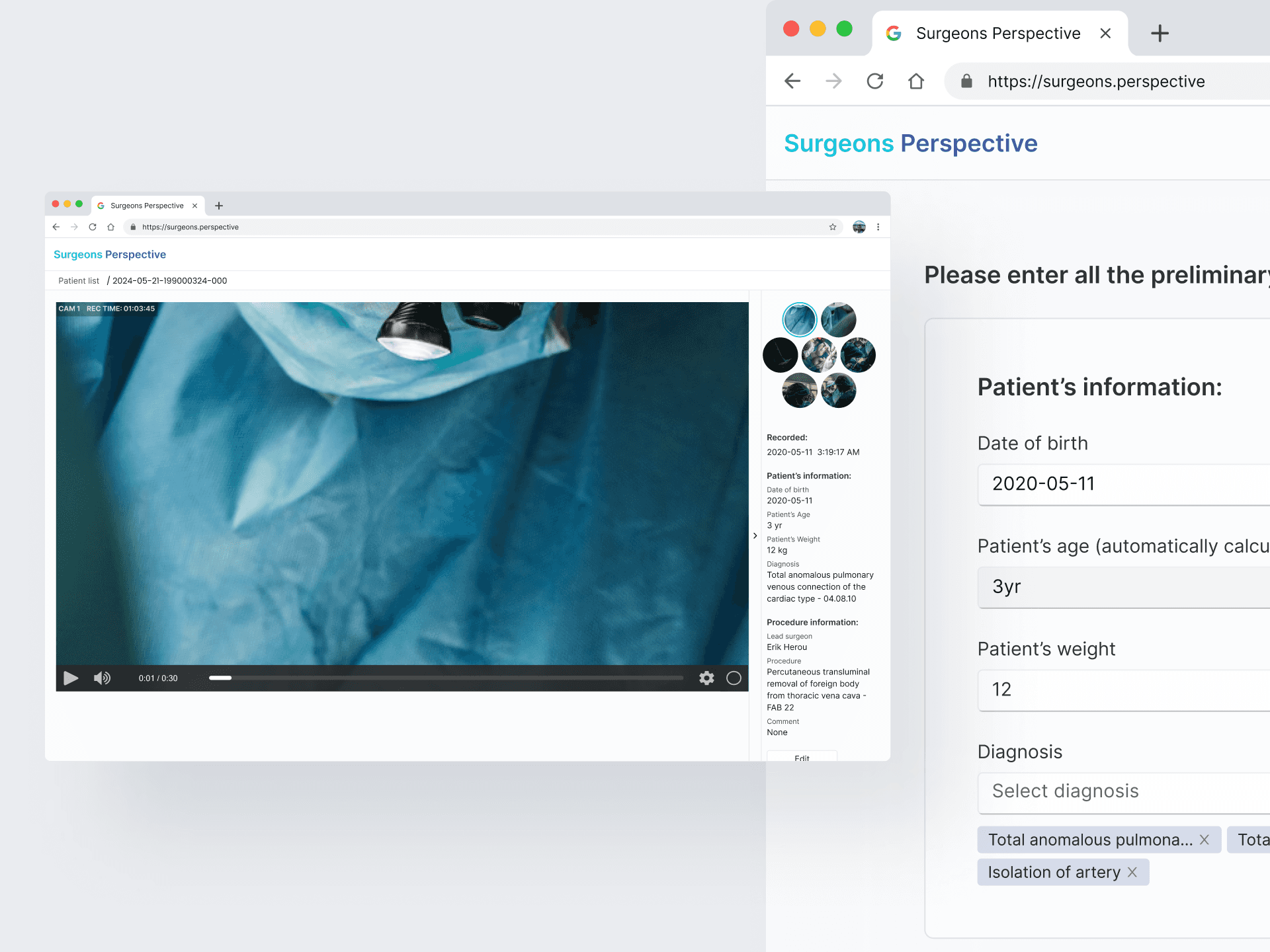 Surgeons perspective mockup