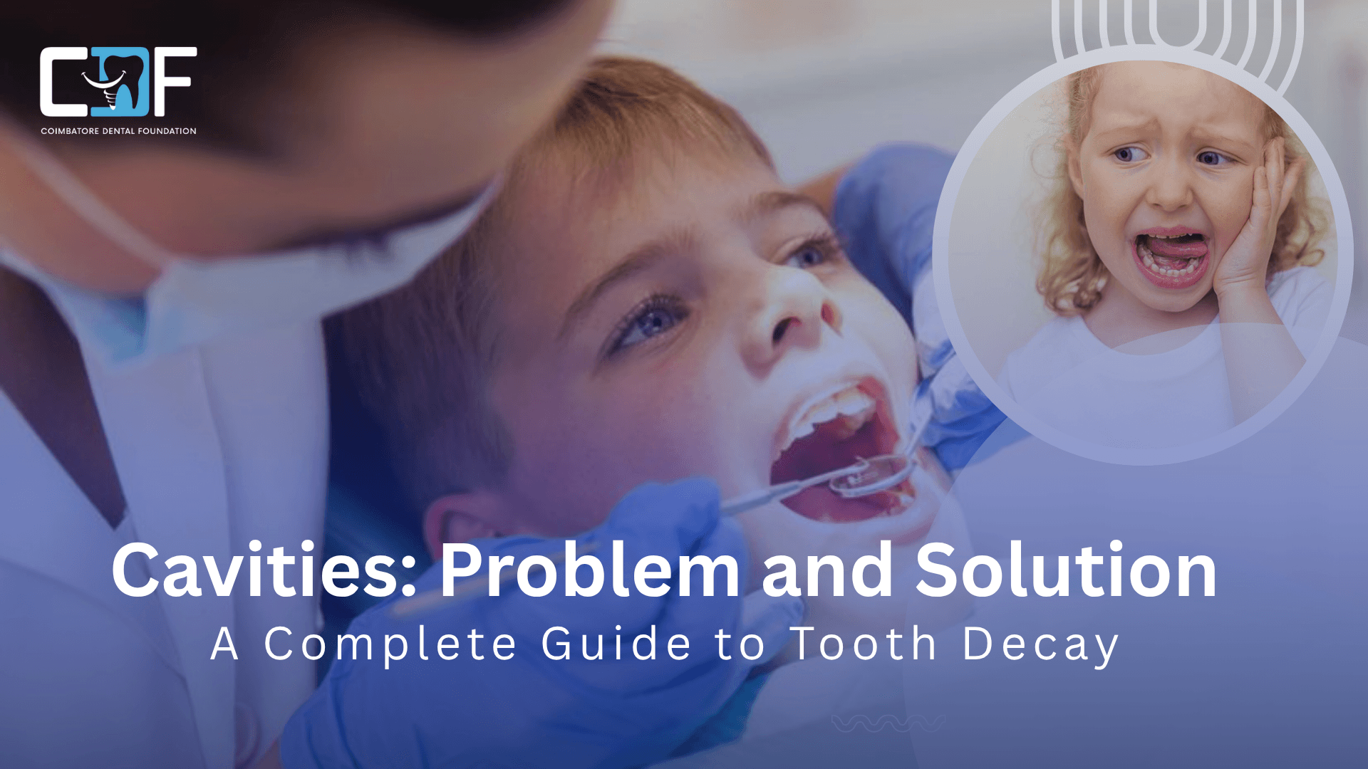 Cavity Treatment and Prevention in Coimbatore 