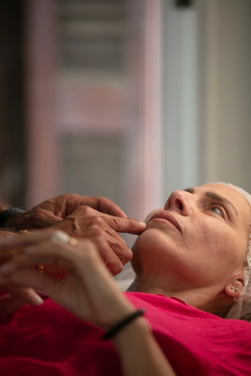 SkinPen® e Microneedling: la nuova frontiera per migliorare la qualità della pelle